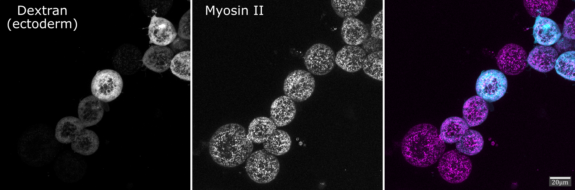Ectoderm and mesoderm Xenopus cells immunostained for Myosin II.